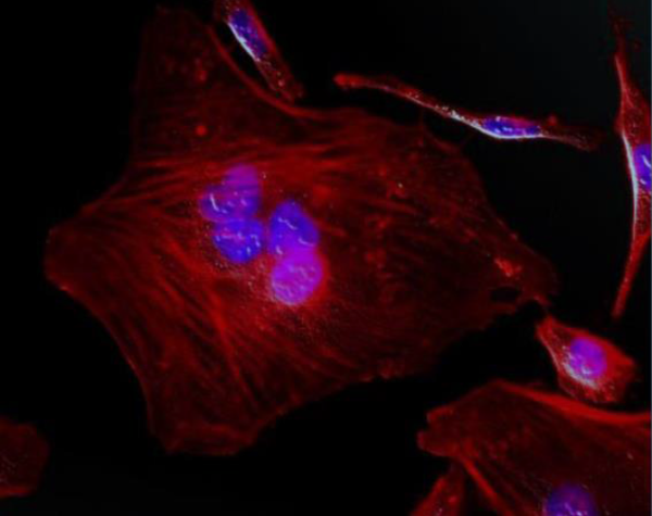 Fig1_FSD_Fluor 594 Phalloidin.png
